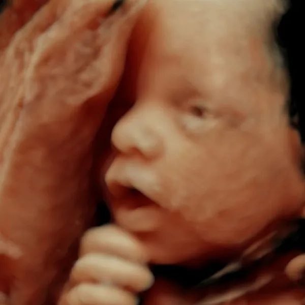 Ecografía Transvaginal en Quito