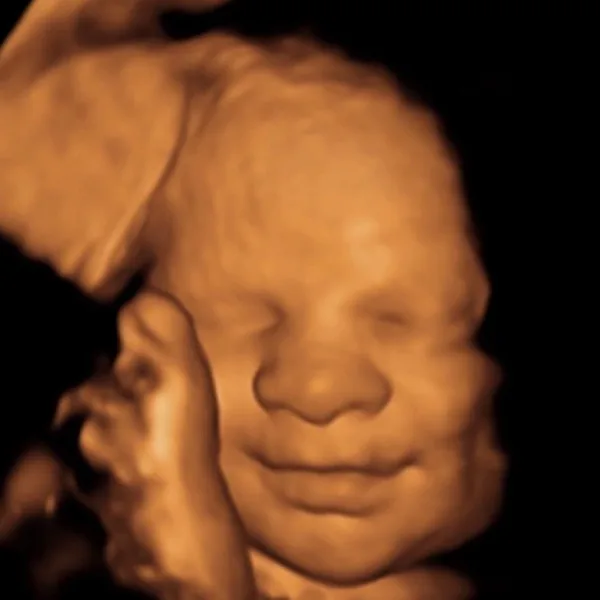 Ecografía Transvaginal en Quito