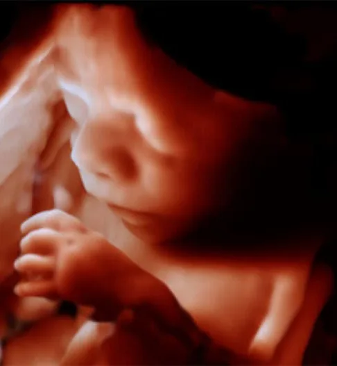 Ecografía Transvaginal en Quito