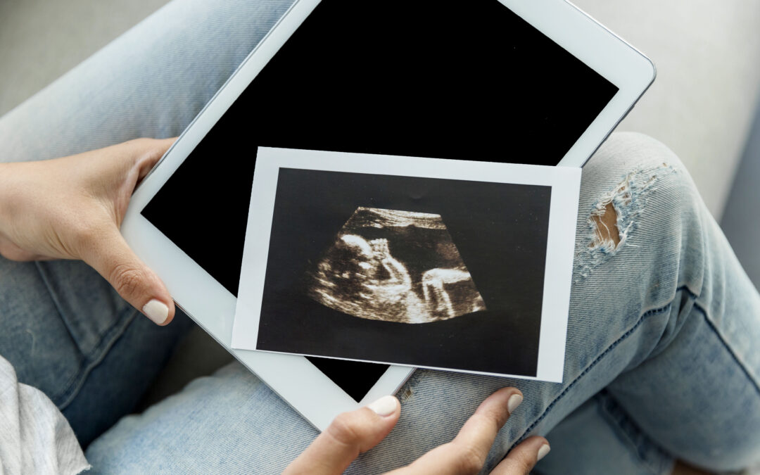 Imprtancia de la ecografía en la semana 20. descubre el sexo del bebé