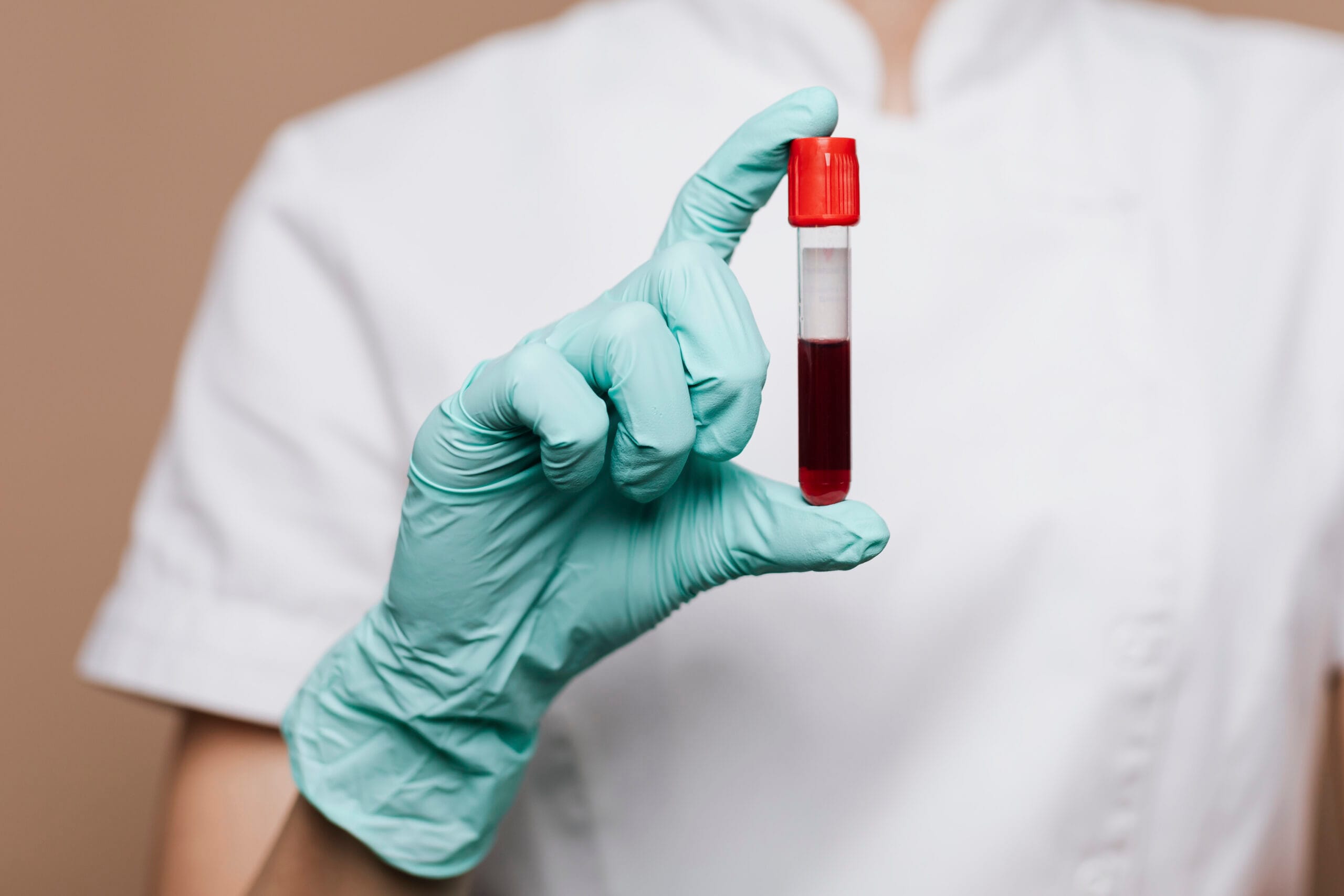 Fmh Test Rhogam ¿Debes colocarte Rhogam si eres Rh negativo en tu embarazo?
