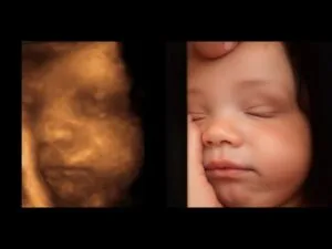 Ecografía Obstétrica para conocer a tu bebé