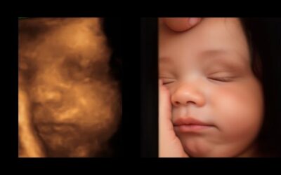 Ecografía 3D, 4D, 5D y Emocional en Quito: Imágenes en Alta Definición con Informe Médico