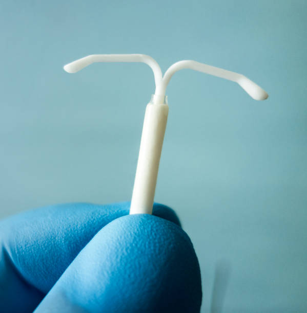 Endoceptivo uterino: anticoncepción inteligente por 5 años y el mayor ahorro en salud femenina