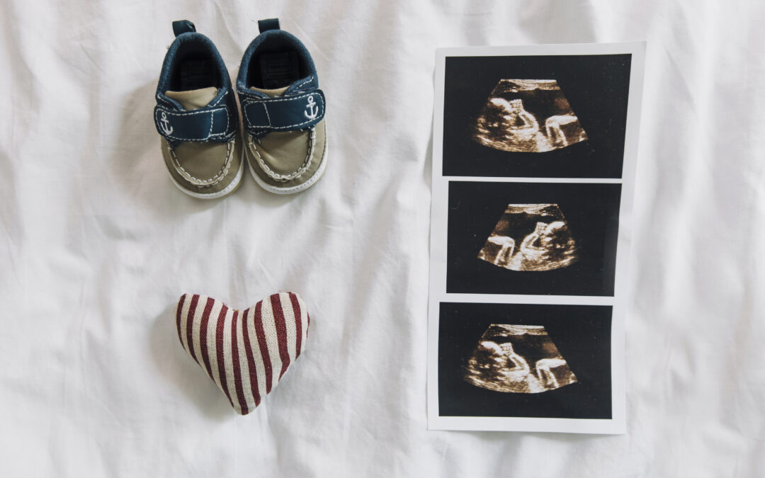 Zapatos de bebé junto a imágenes de ecografía fetal en blanco y negro sobre una sábana blanca