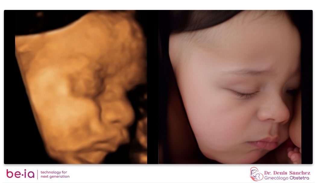 Imagen de ecografía prenatal 4D emocional o hiperrealista realizada en Quito por el Dr. Denis Sánchez