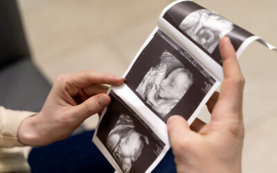 ¿Es seguro realizarse varias ecografías durante el embarazo? Esto dice la ciencia y la experiencia médica