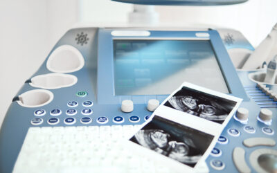 ¿Ecografía en el primer trimestre? Lo que NADIE te dice pero es crucial