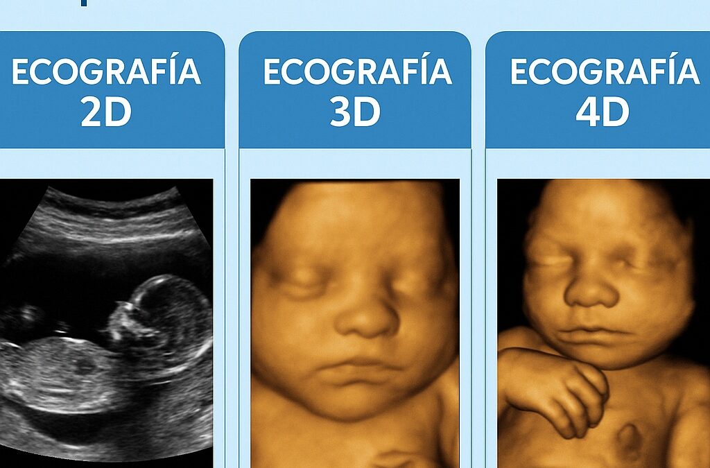 Infografía comparativa que muestra ecografía 2D, 3D y 4D en embarazo para determinar el sexo del bebé