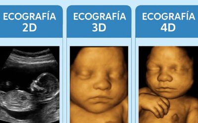 ¿Qué ecografía es más confiable para saber el sexo del bebé?