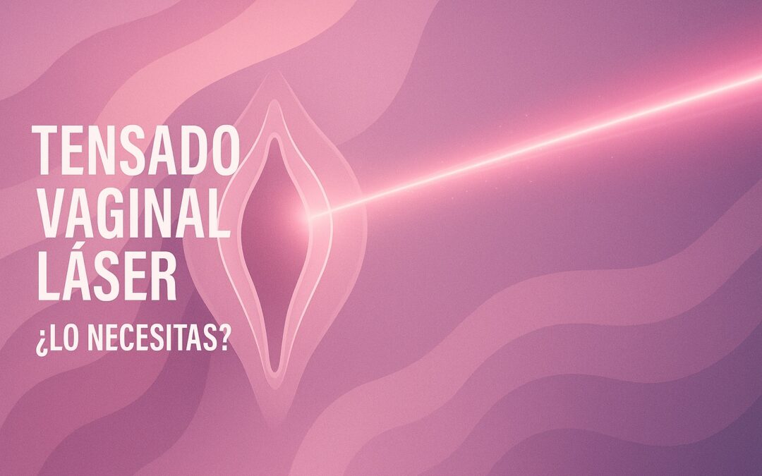 Ilustración abstracta en tonos rosados con luz láser y texto “Tensado vaginal láser – ¿Lo necesitas?”, representando rejuvenecimiento íntimo.