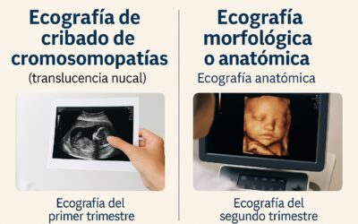 Ecografía de cribado de cromosomopatías (translucencia nucal) y ecografía morfológica en Quito