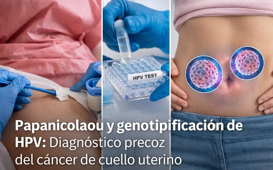 🩺 Importancia del Papanicolaou y la genotipificación de HPV para el diagnóstico precoz del cáncer de cuello uterino