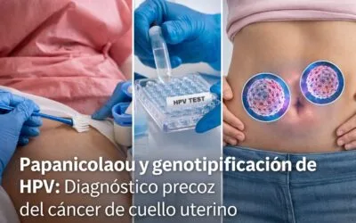 🩺 Importancia del Papanicolaou y la genotipificación de HPV para el diagnóstico precoz del cáncer de cuello uterino