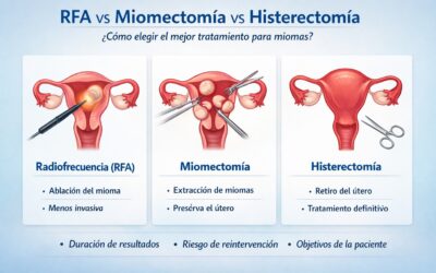 Radiofrecuencia (RFA) para miomas vs miomectomía tradicional vs histerectomía: diferencias reales, límites y cómo elegir bien