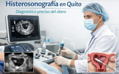 Histerosonografía en Quito: qué es, para qué sirve y cuándo se recomienda
